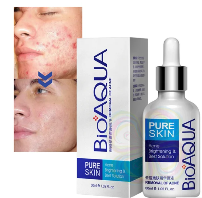 Serum Anti Acne Bioaqua Pure Skin