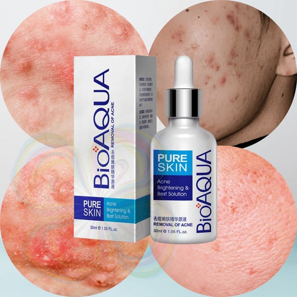 Serum Anti Acne Bioaqua Pure Skin