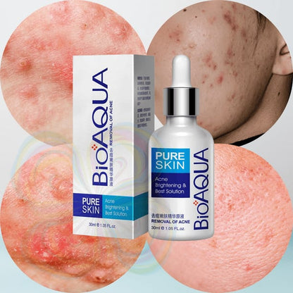 Serum Anti Acne Bioaqua Pure Skin