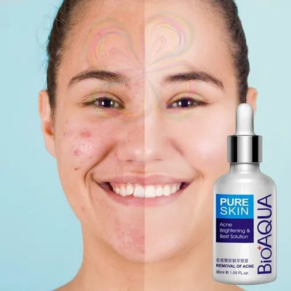 Serum Anti Acne Bioaqua Pure Skin