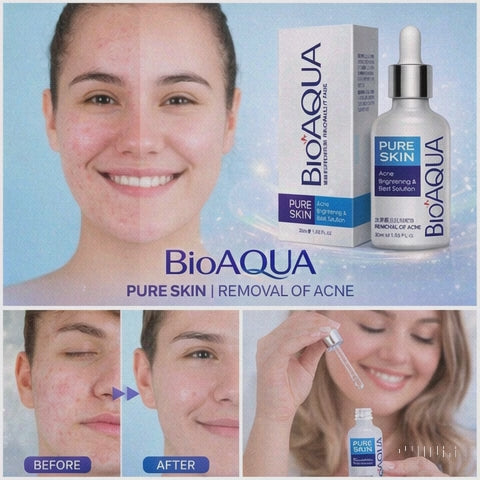 Serum Anti Acne Bioaqua Pure Skin